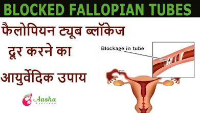 Infertility Treatment with Ayurveda gallery image