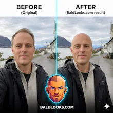 BaldLooks gallery image
