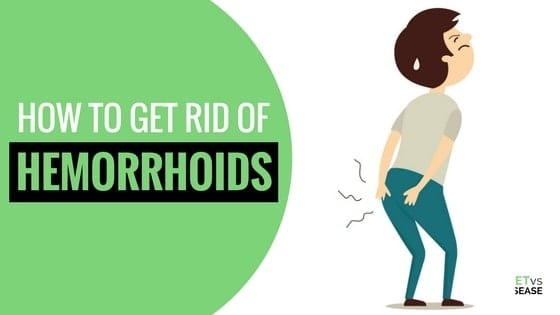 Get Rid Of Hemorrhoids Permanently
