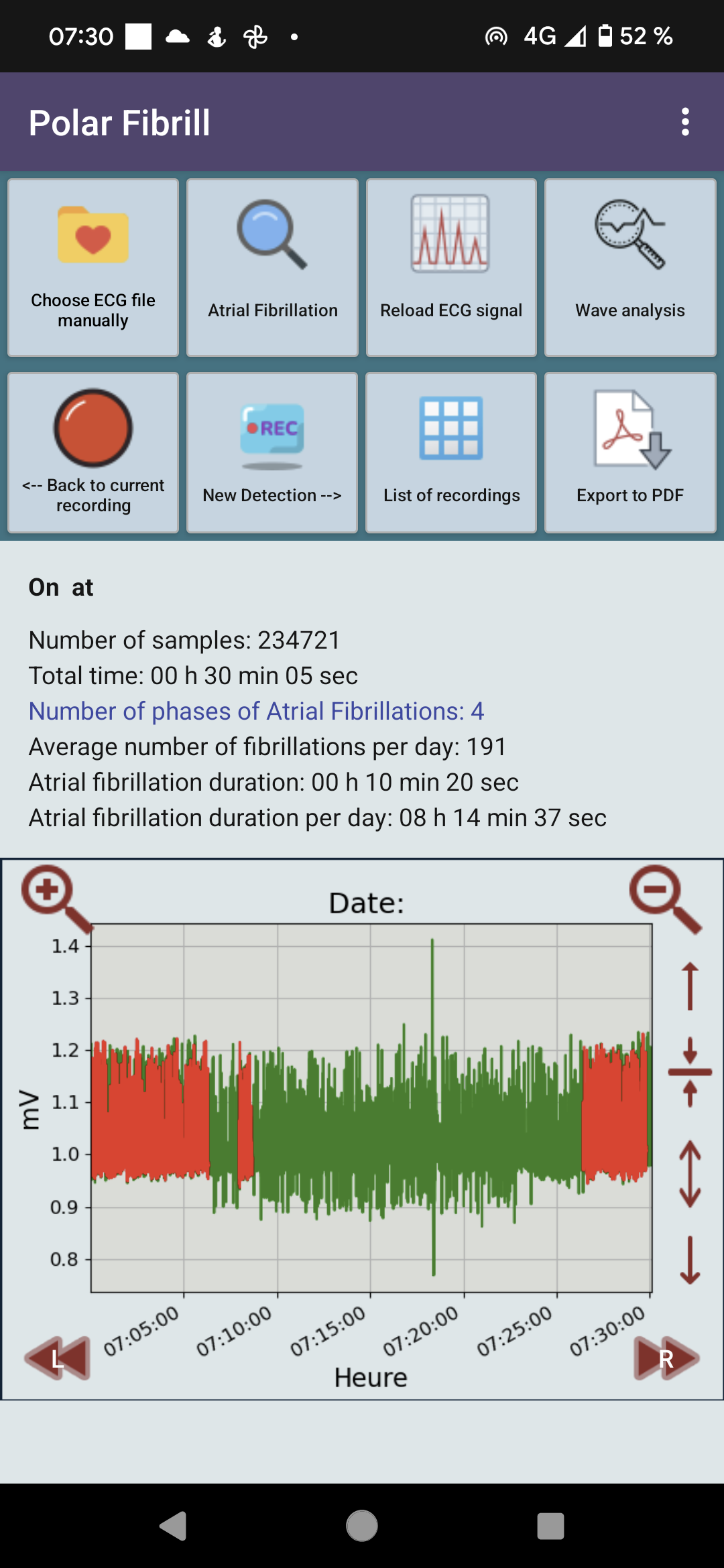 Polar H10 Fibrillation Search - Screenshot 2 showing product features and functionality