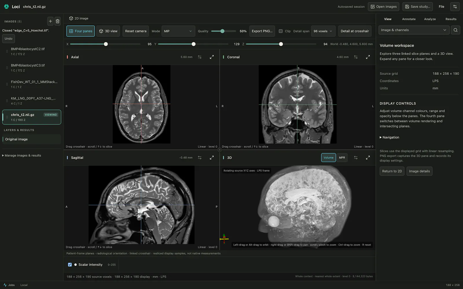 Loci screenshot 2