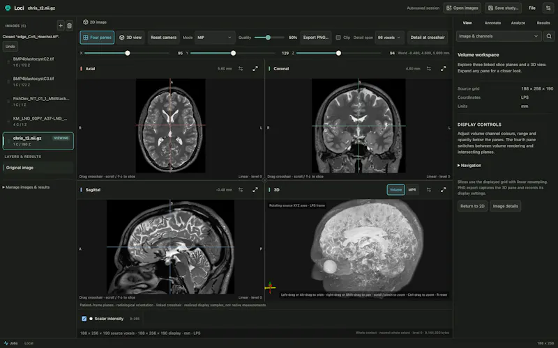 Loci screenshot 2