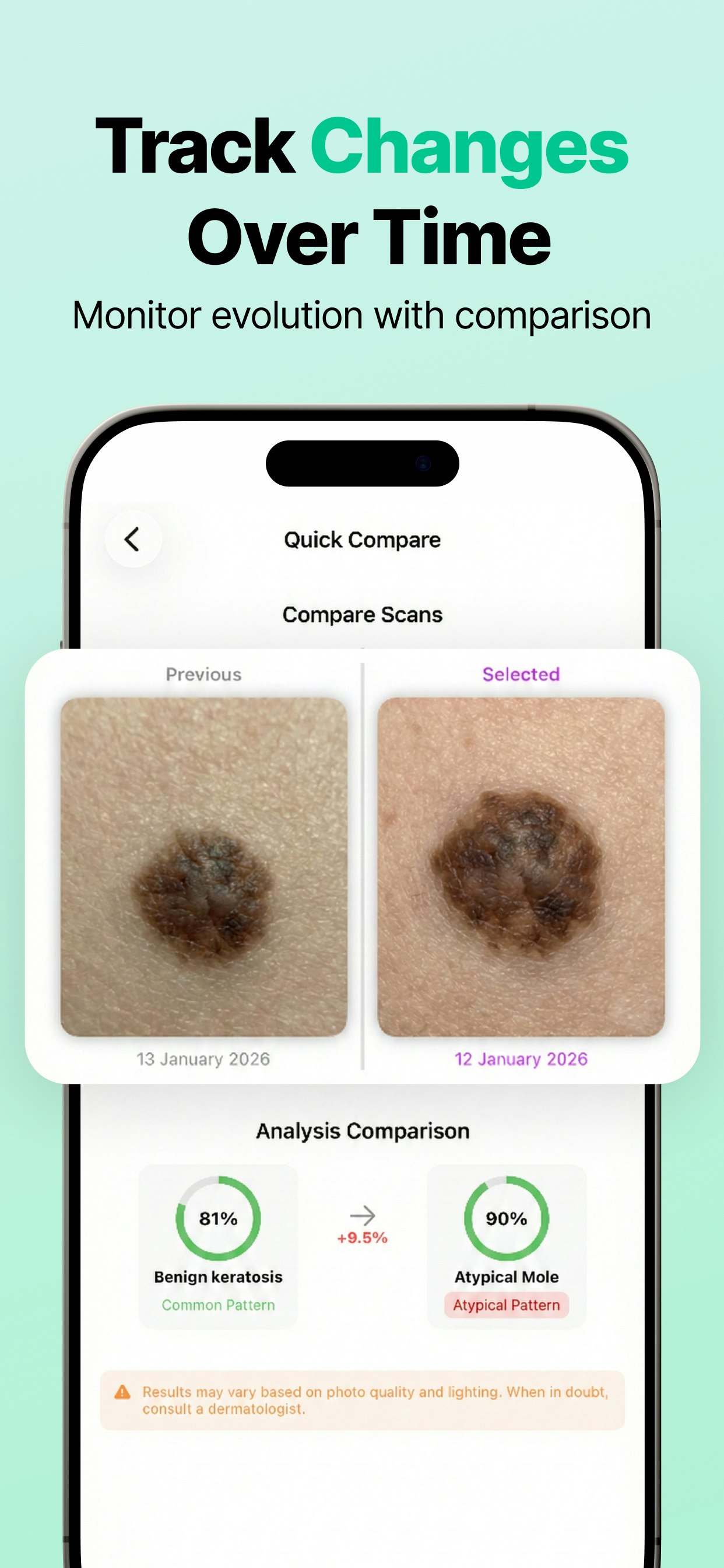 AI Mole Analyzer - Screenshot 3 showing product features and functionality