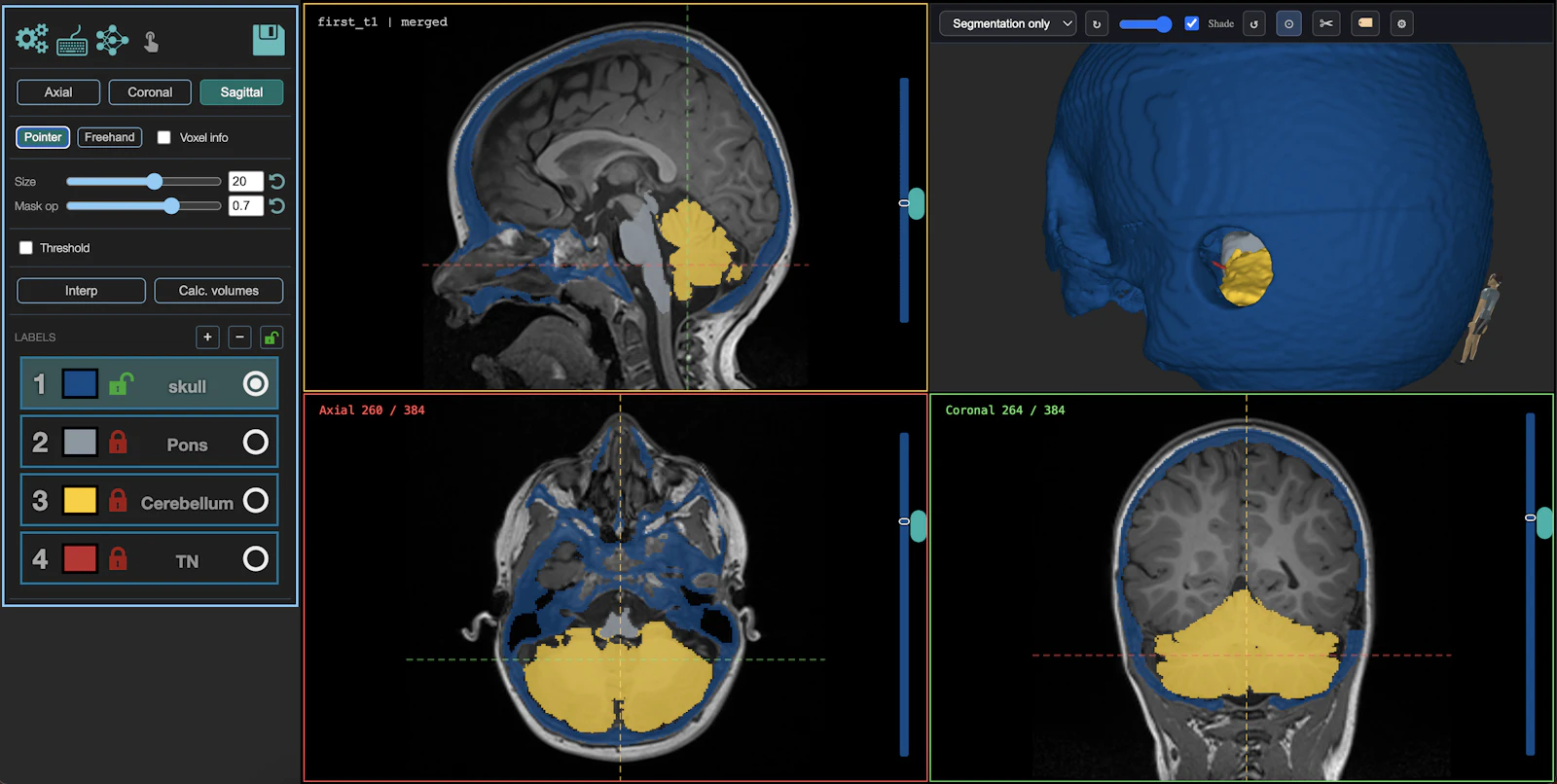 MedSeg screenshot 5