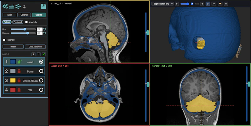 MedSeg screenshot 5