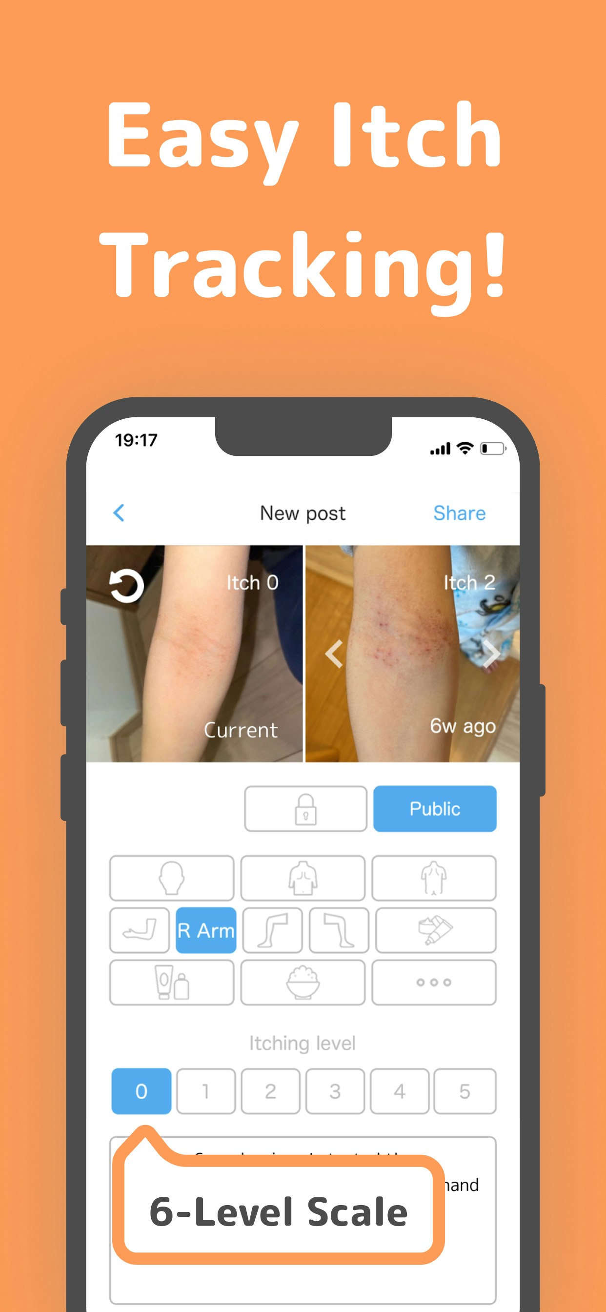 Visual Eczema Care - AtOPiyo - L'app Eczema numero 1 del Giappone - 29 K utenti, ora avviati negli Stati Uniti. media 6