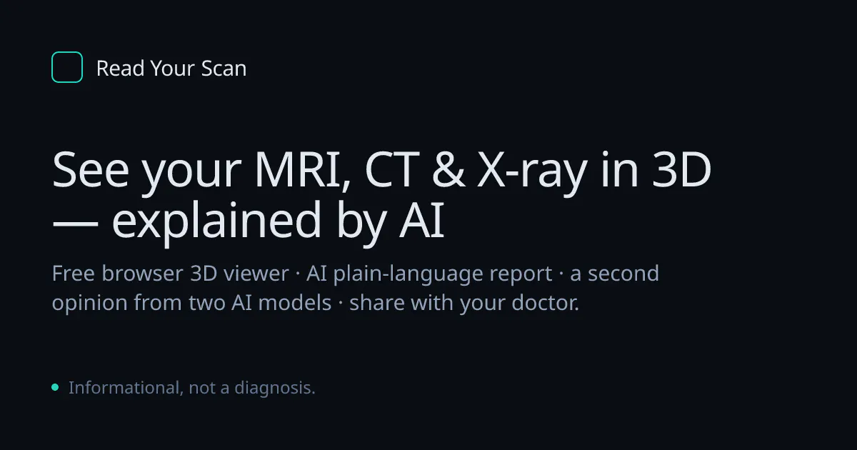 Read Your Scan gallery image