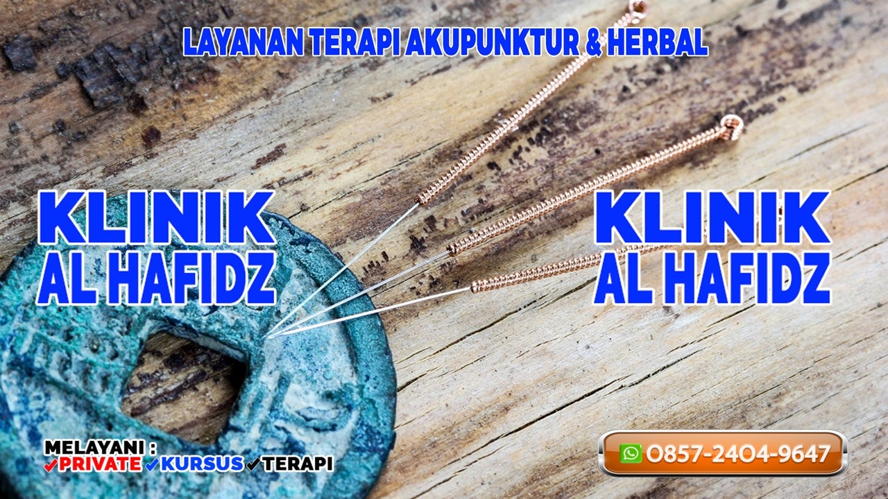 Media Terapi Rawatan Akupunktur Purwakarta - Purwakarta akupunktur 4