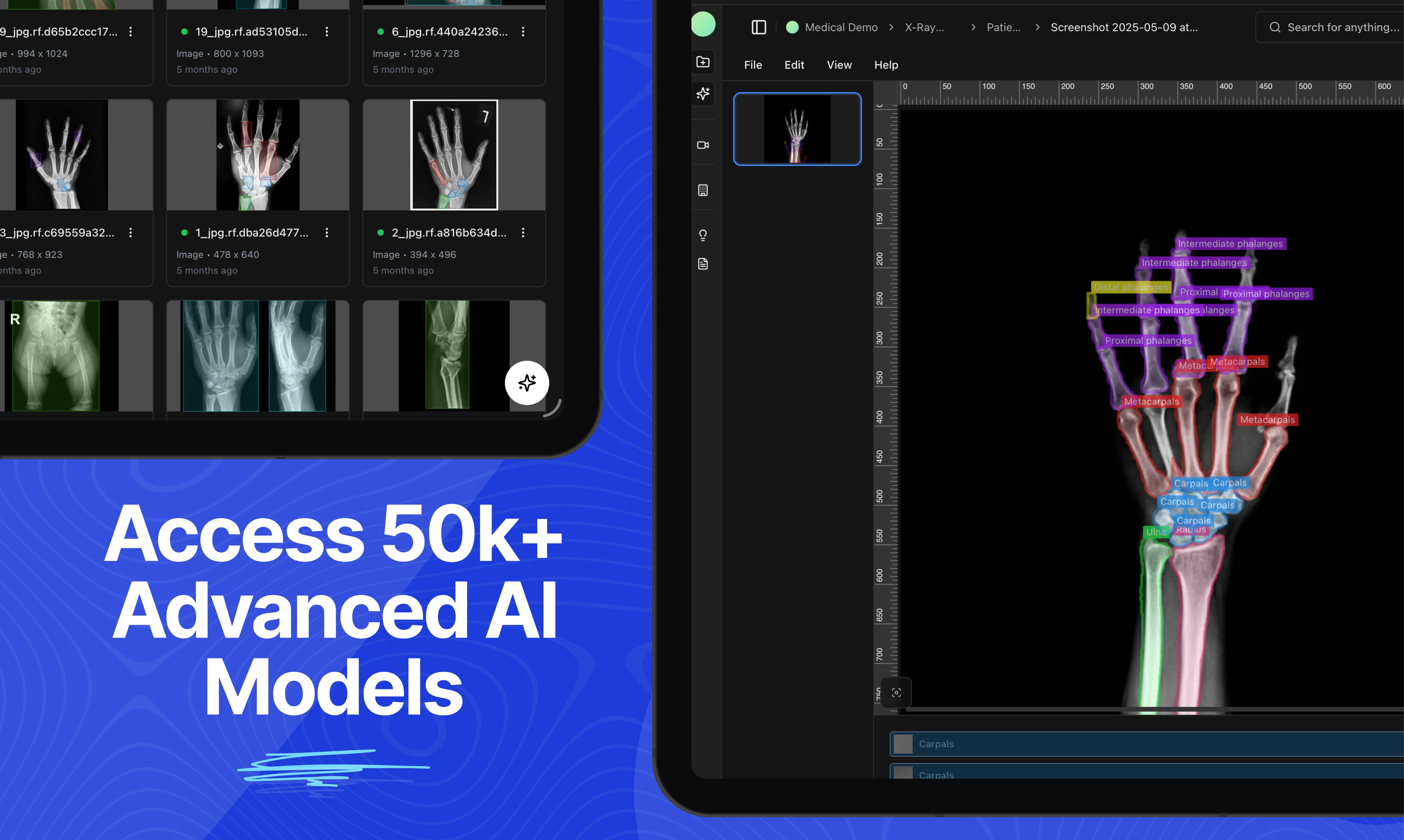CoreViz – Your Photo Copilot - Screenshot 5 preview
