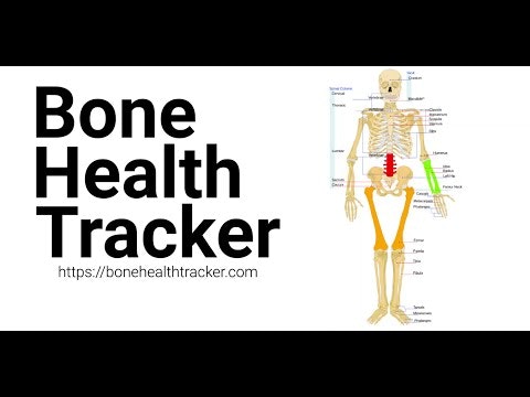 Bone Health Tracker gallery image