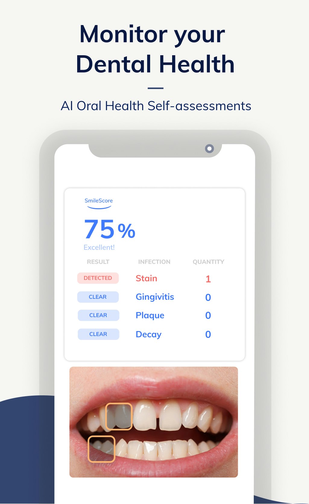 SnapSmile gallery image