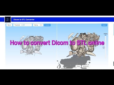 DicomtoSTL gallery image