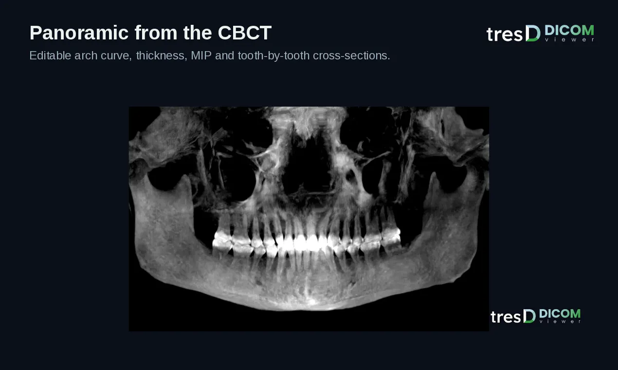 tresD DICOM gallery image