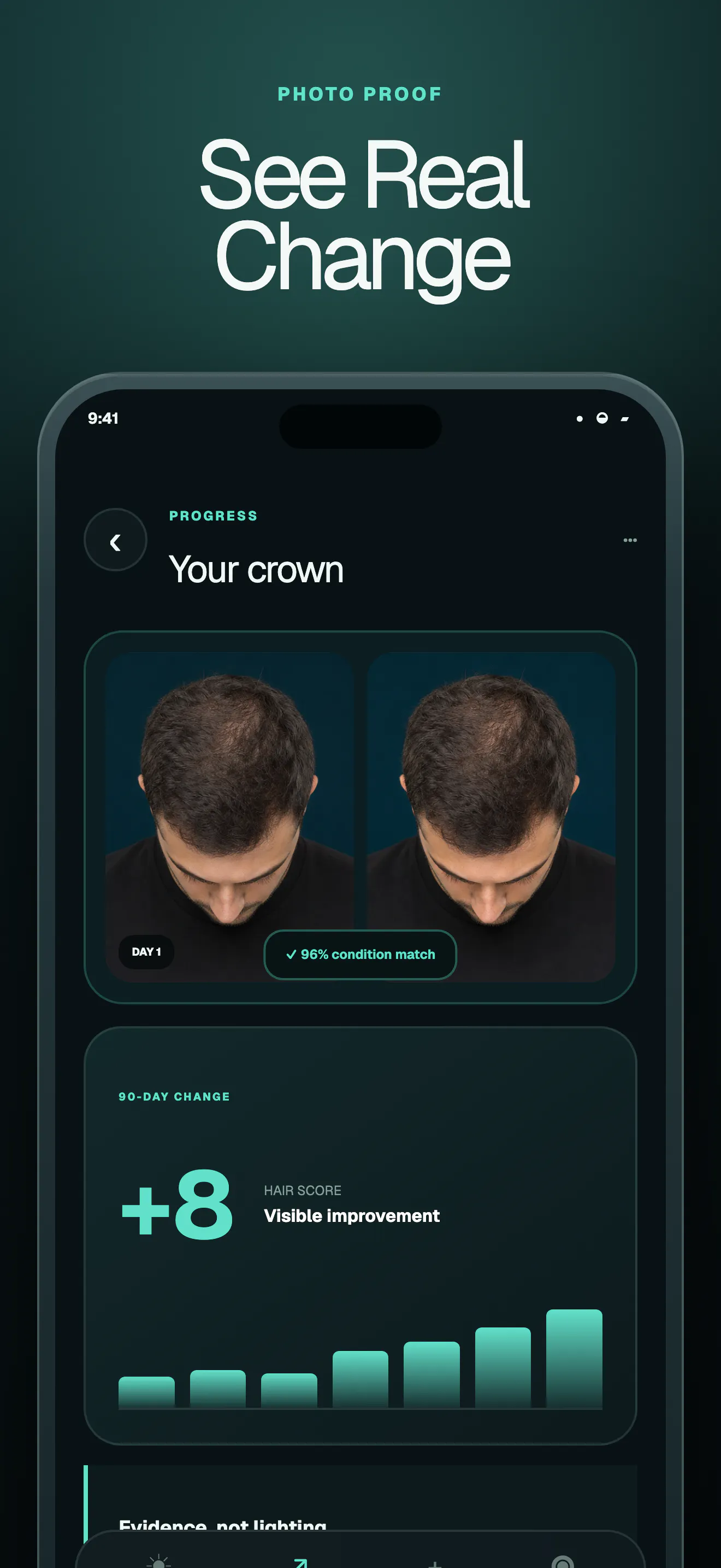 BALD AI: Hair Loss Tracker gallery image