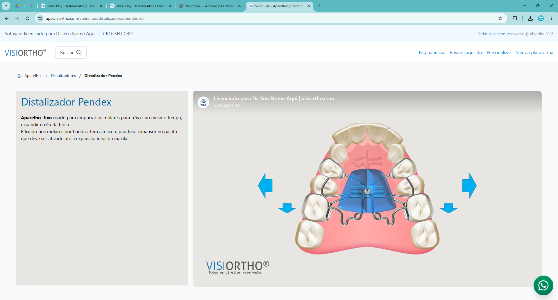 VISIORTHO gallery image