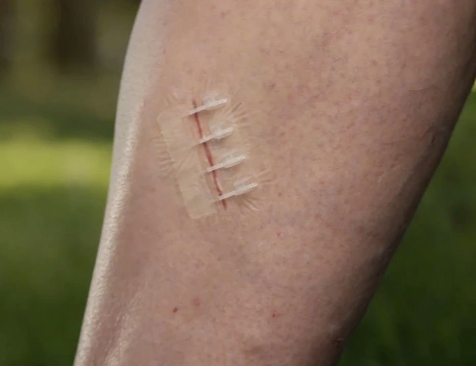 ZipStitch ⛑ gallery image