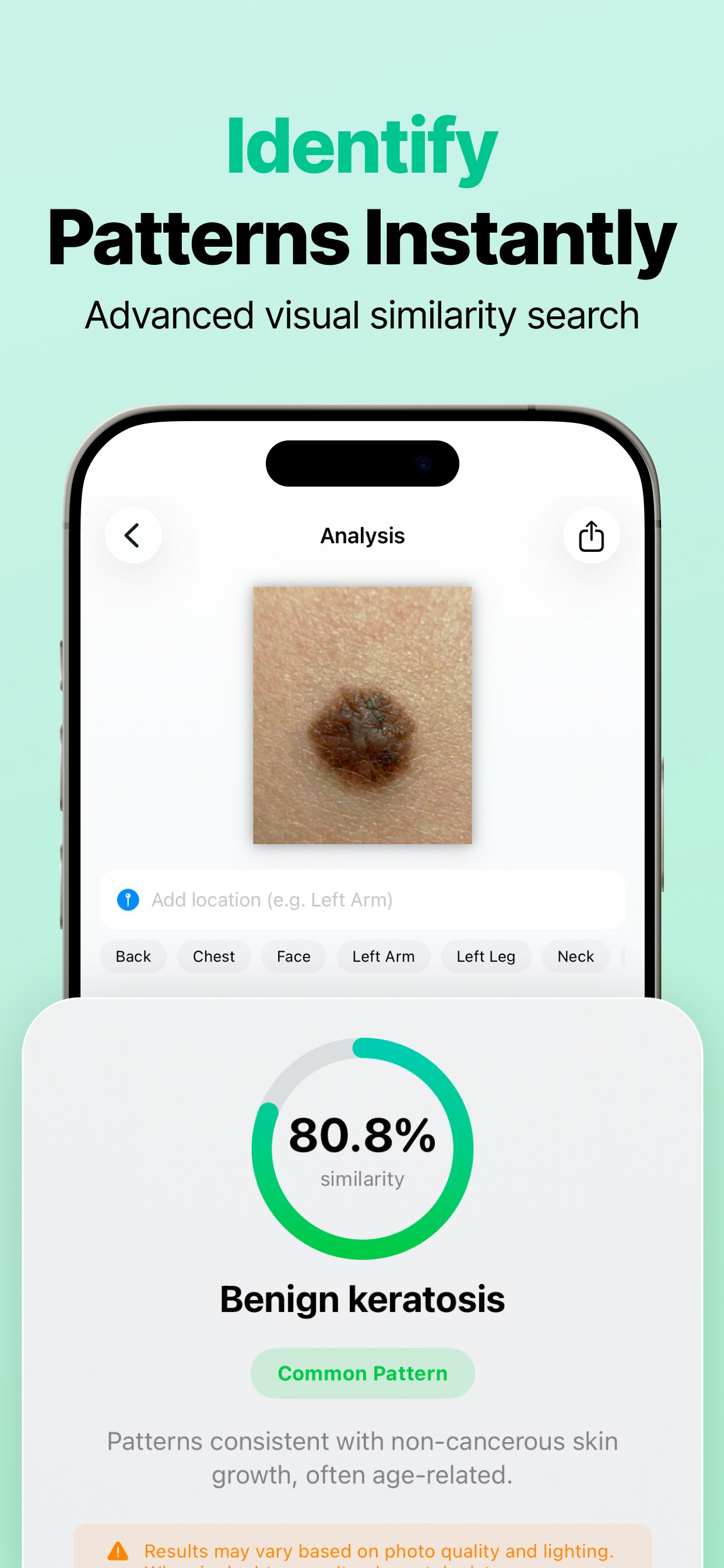AI Mole Analyzer gallery image