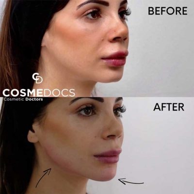 Cosmetic Skin | Aesthetic Clinic London gallery image
