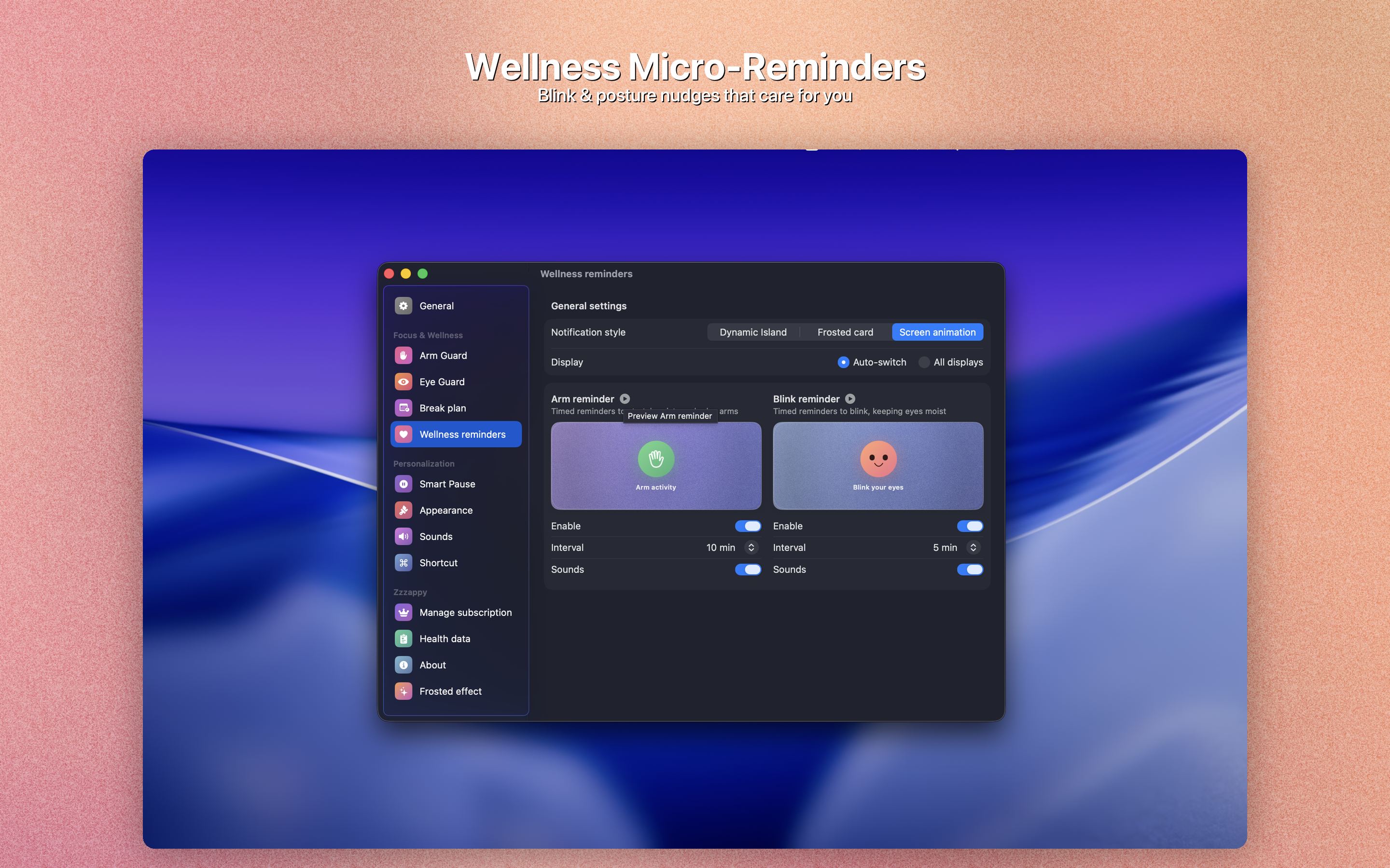 Zzzappy gallery image