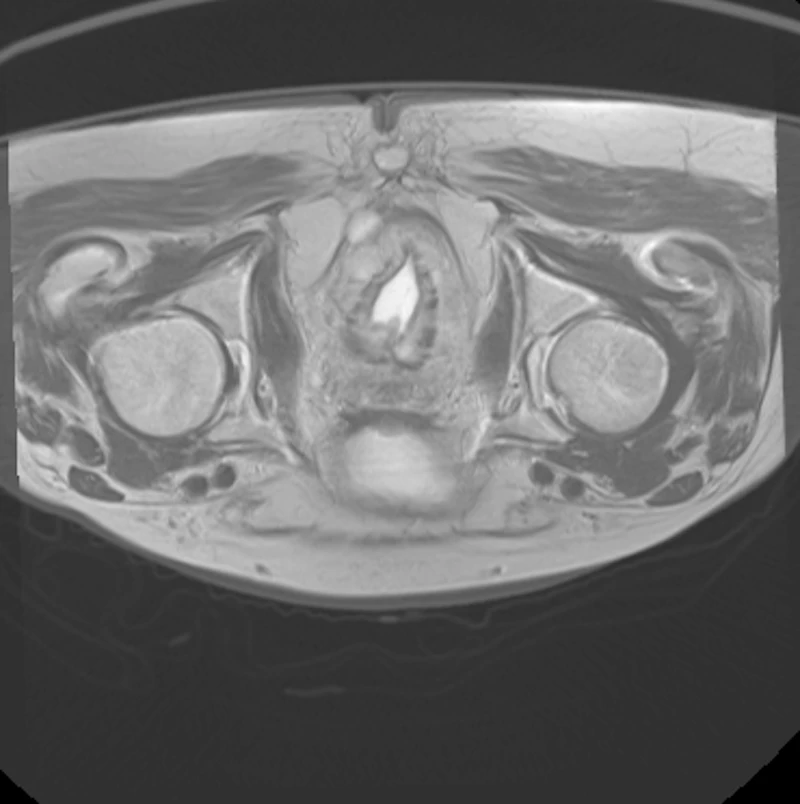 Multimodal image registration screenshot 7