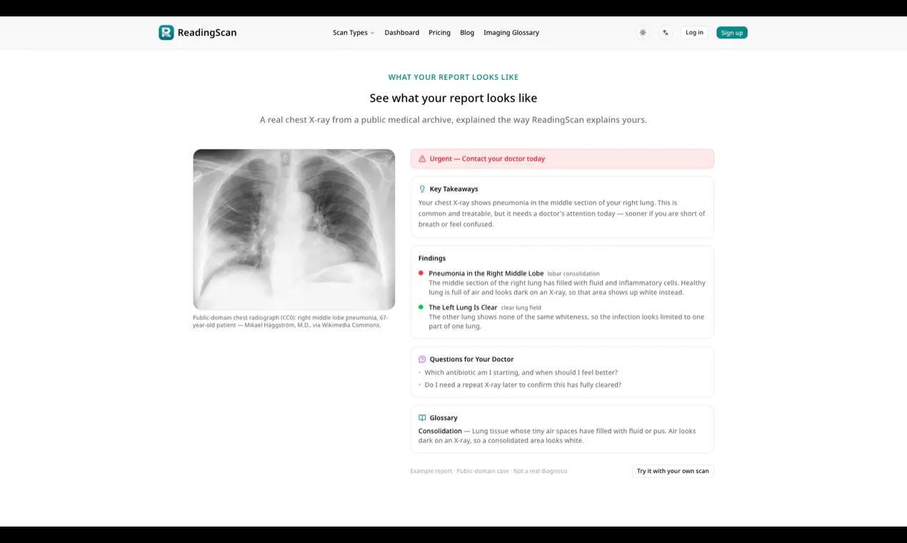 ReadingScan gallery image