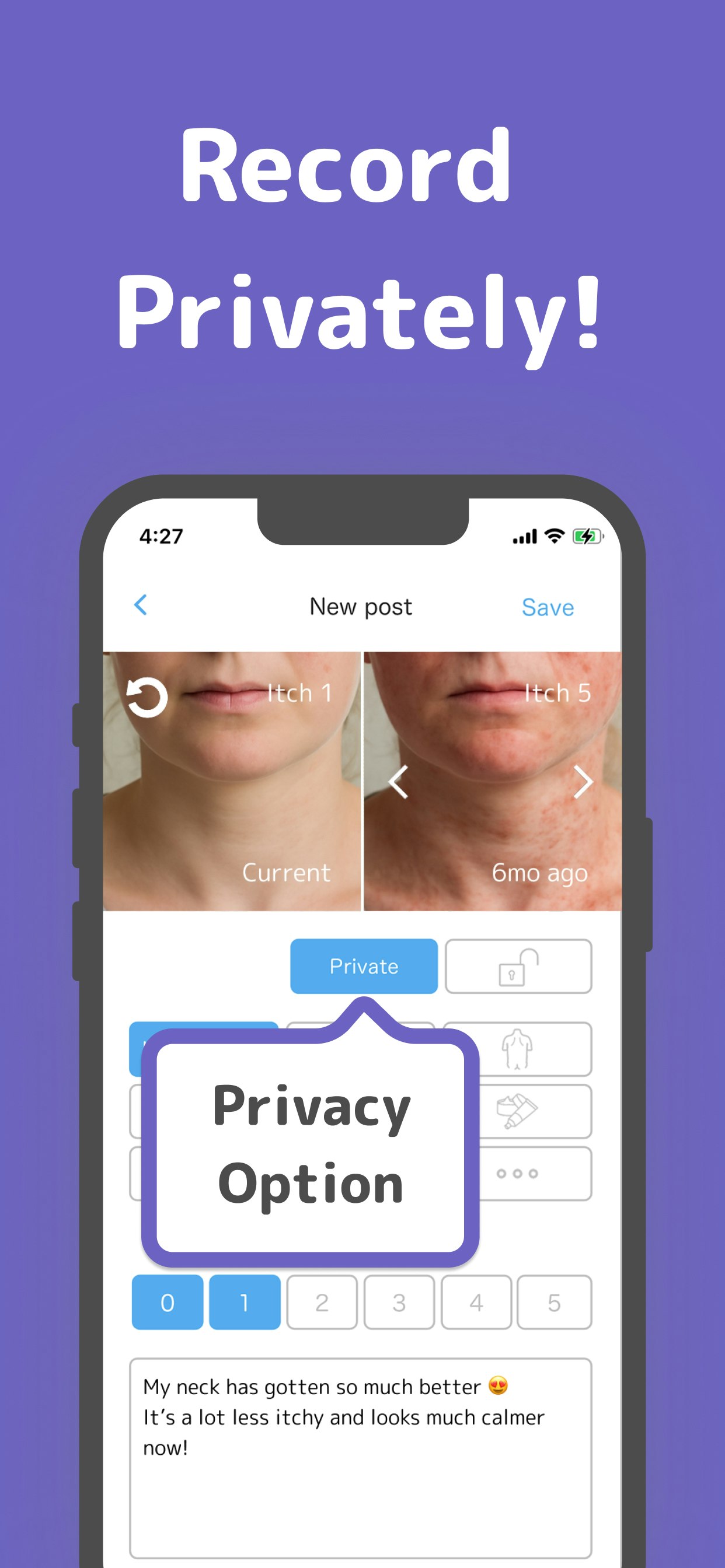 Visual Eczema Care - AtOPiyo - L'app Eczema numero 1 del Giappone - 29 K utenti, ora avviati negli Stati Uniti. media 3