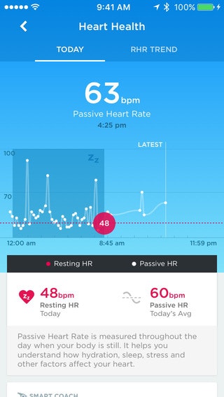 Up by Jawbone gallery image