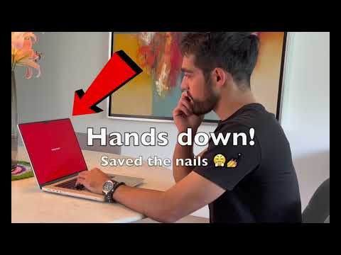 Hands Down gallery image