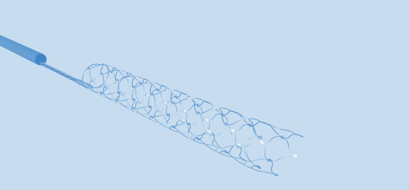 Synchron gallery image