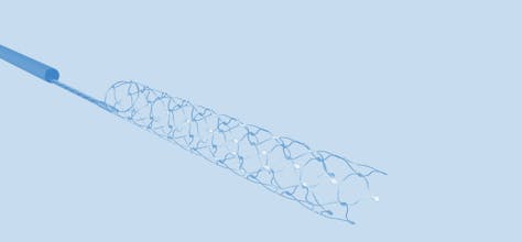 Synchron gallery image