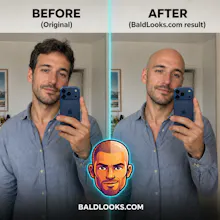 BaldLooks gallery image