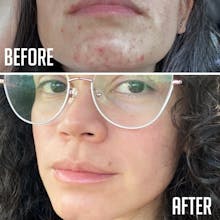 Hydro Glow + Smooth & Even Serum gallery image