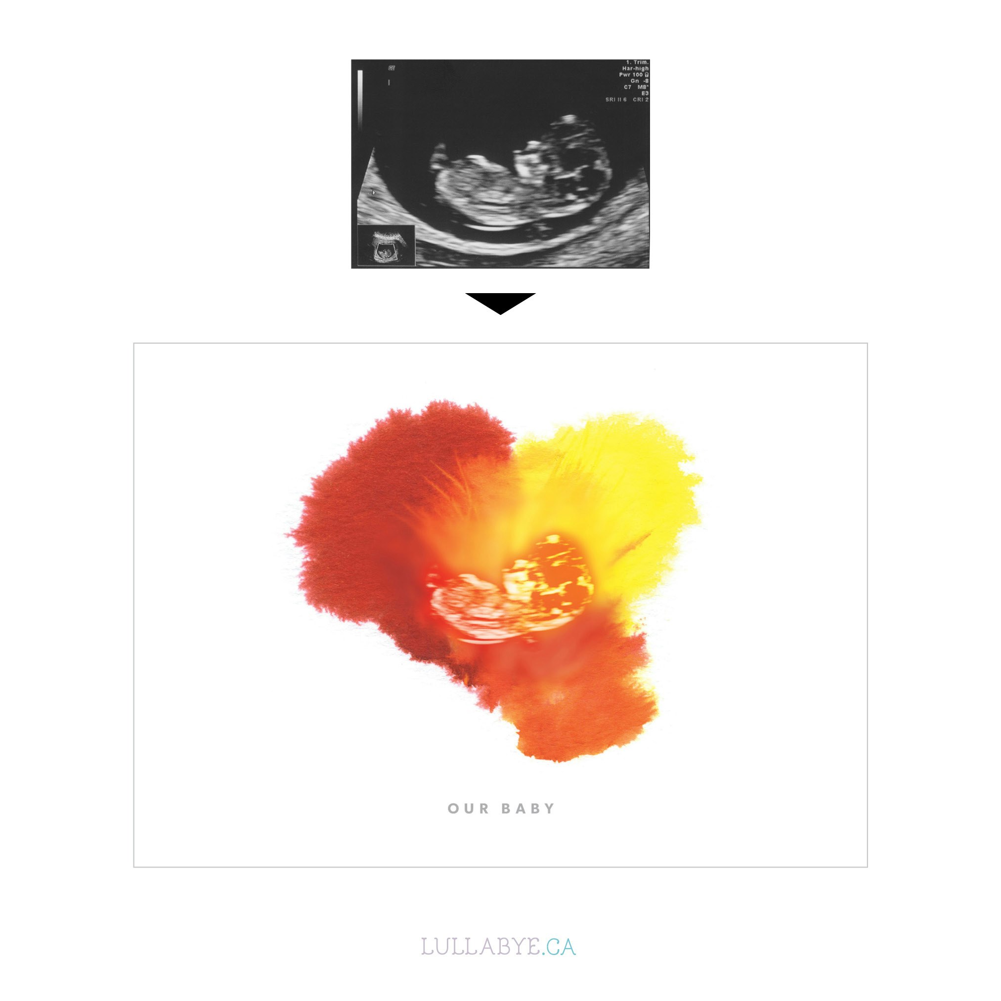 Sonogram Image Baby Memorial Keepsake