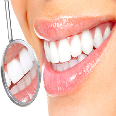 Teeth Whitening