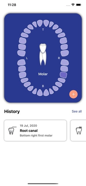 PocketDent gallery image