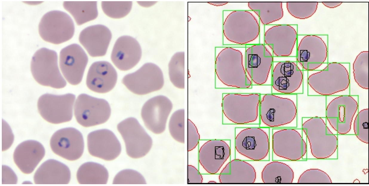 fuMalaria.com gallery image