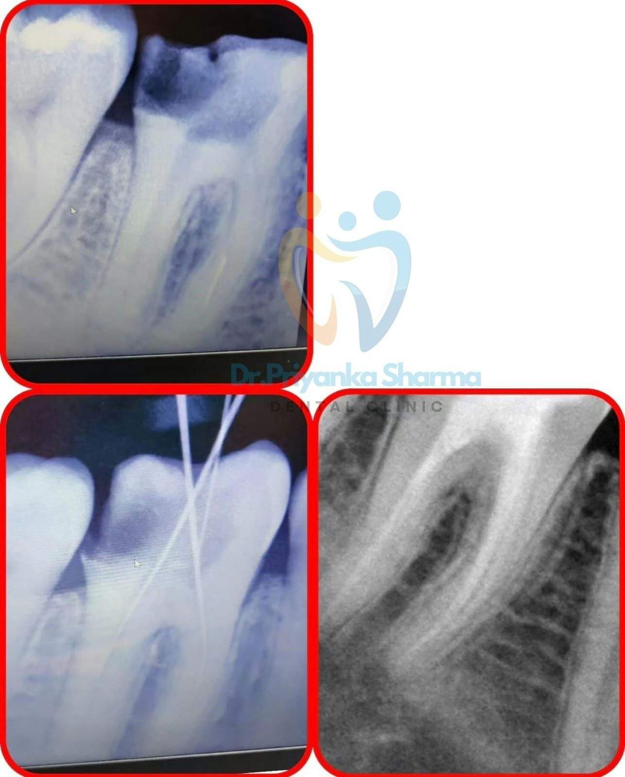 Dr Priyanka Sharma Dental Clinic gallery image