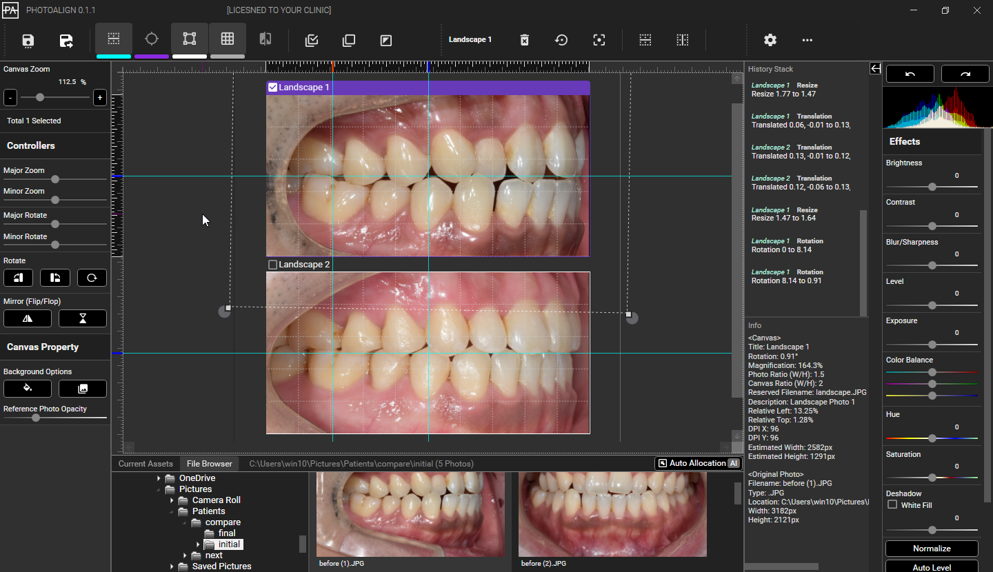 Photoalign Studio - 临床牙科照片编辑和管理软件媒体3