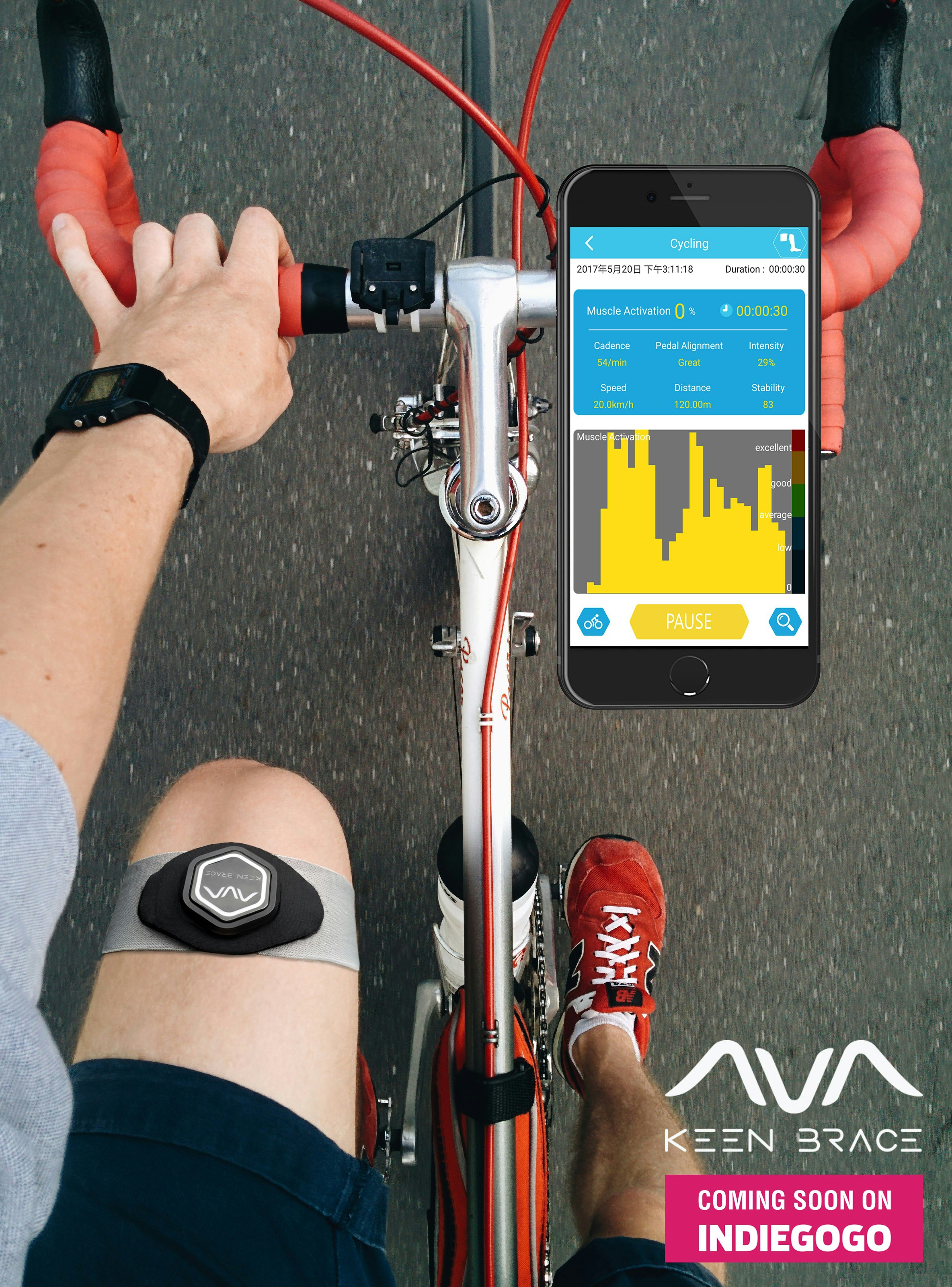 KeenBrace gallery image