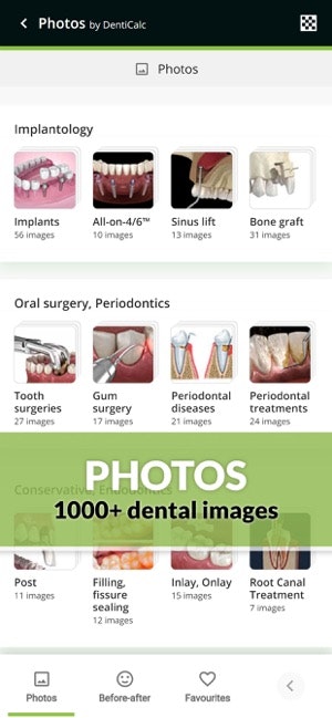 DentiCalc gallery image