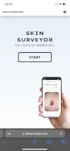 Skin Surveyor gallery image