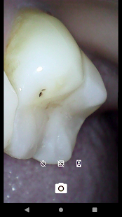 Cavity gallery image