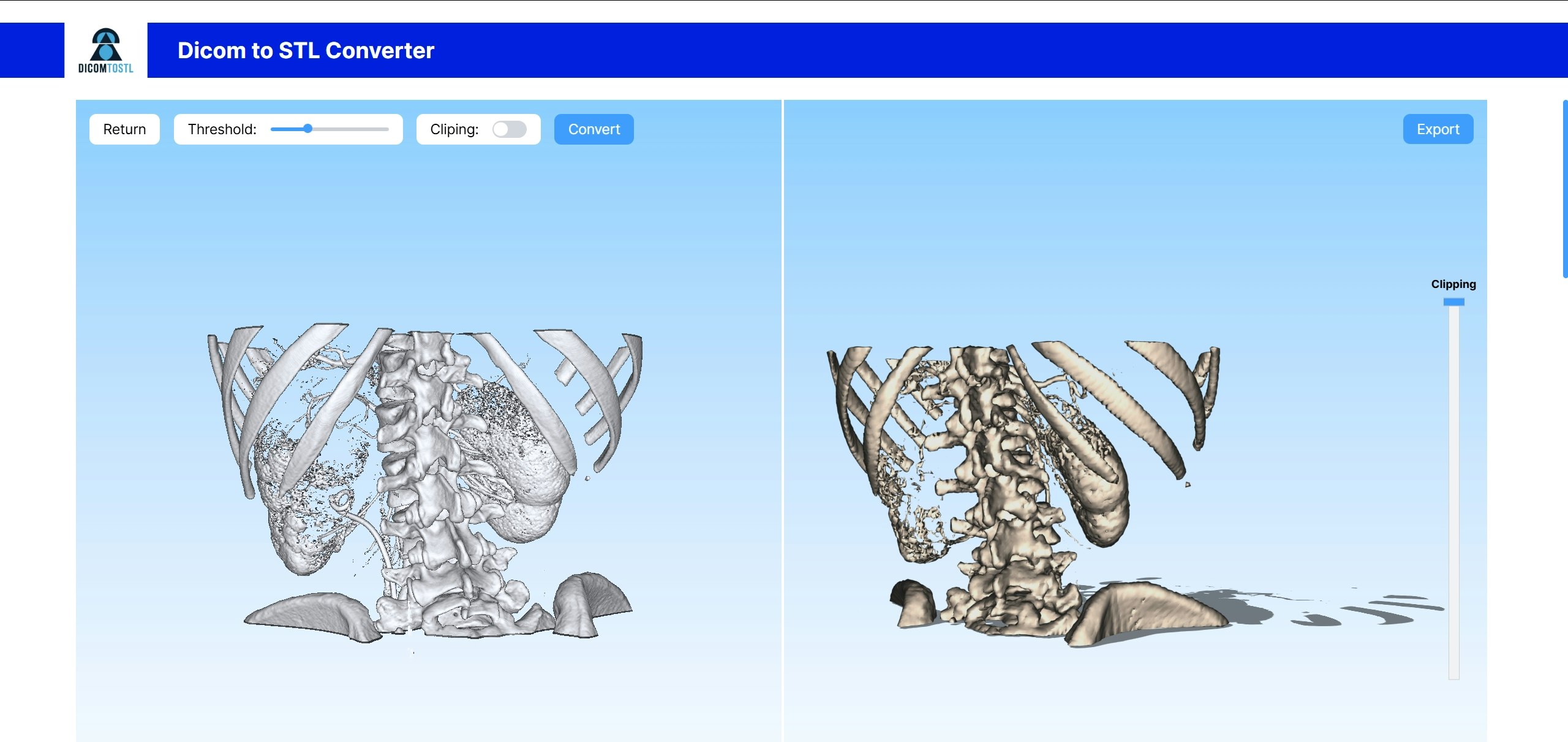dicomtostl - DICOM2STL, 의료 3D 모델 생성기, DICOMTOSTL 변환기 미디어 3