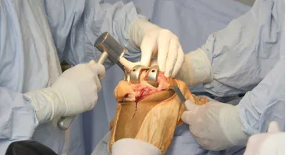 Dr. Vikramjit Singh Baath | ORTHOPRO gallery image