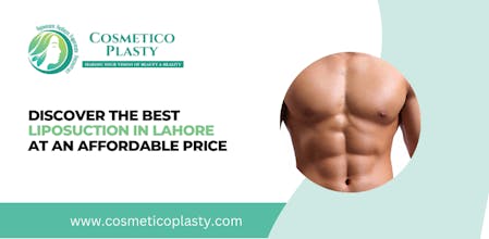 Liposuction in Lahore gallery image
