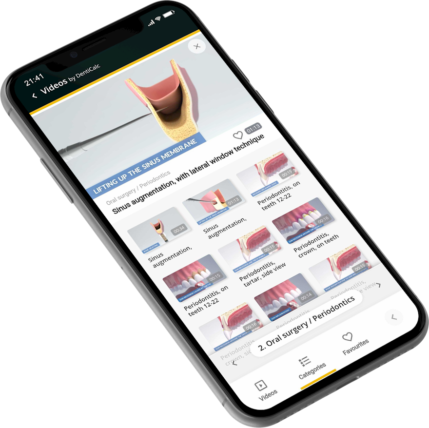 DentiCalc gallery image