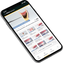 DentiCalc gallery image