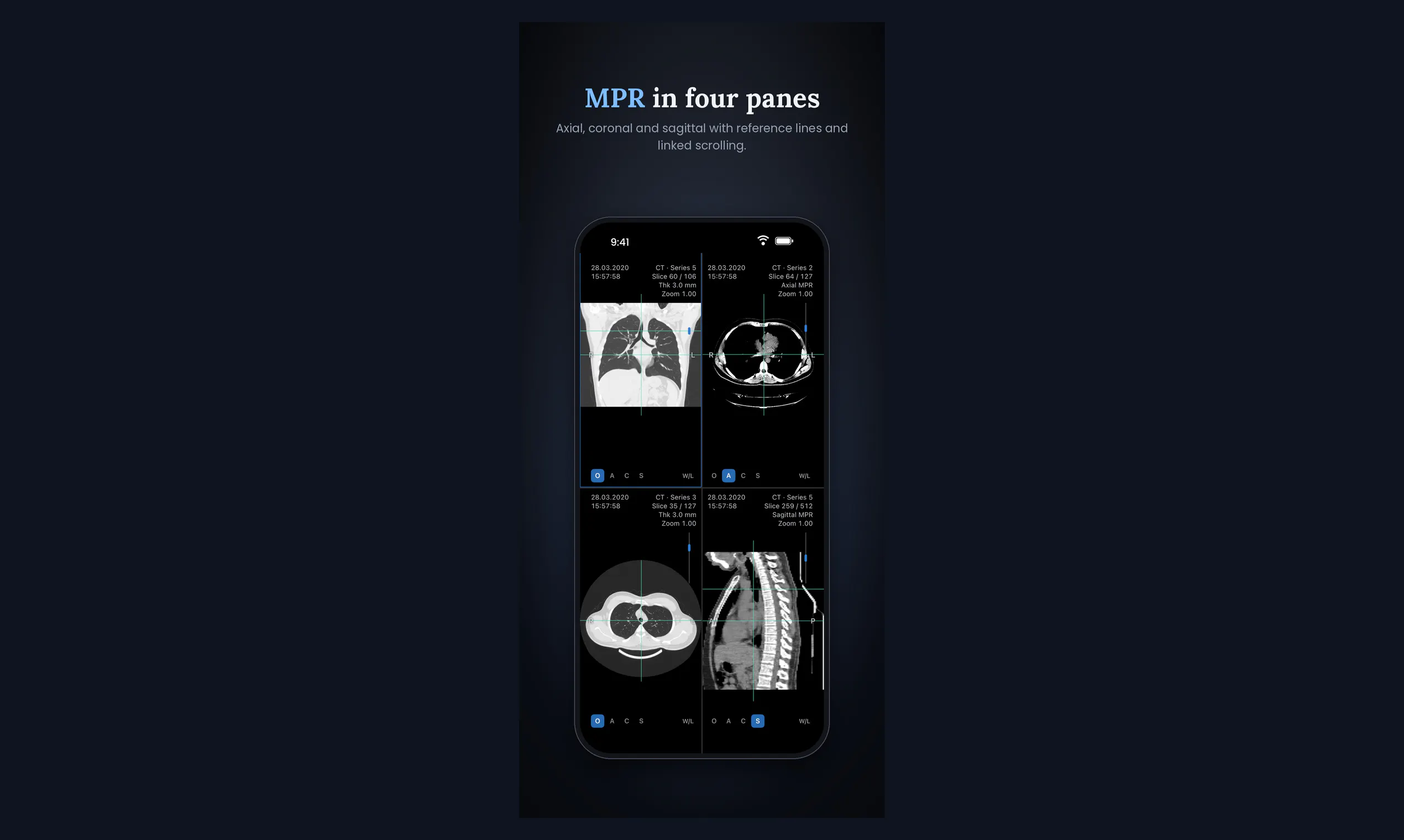 P Viewer gallery image