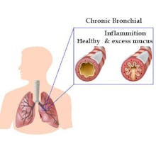 BUY Healthvit Amda Amla Powder gallery image