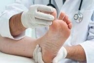 Podiatric Sports Medicine Doctor LA gallery image